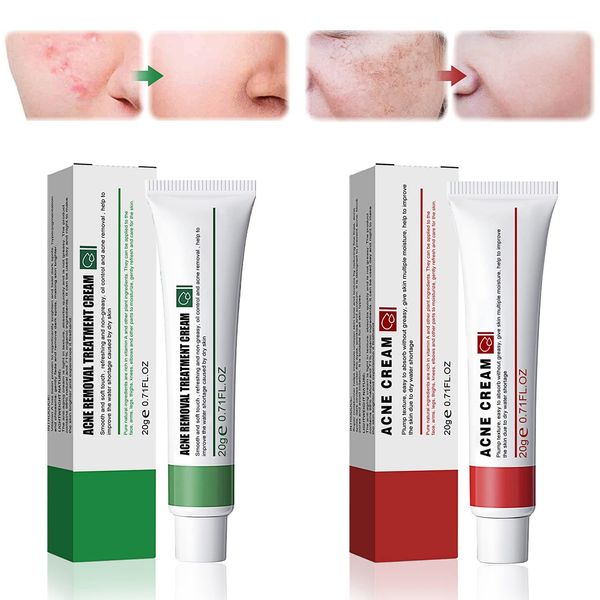 Miioto Pigmentflecken Creme 20g+Anti Pickel Creme 20g, Anti-Akne Anti-Pigmentierungscreme 2 in 1 Set für Dark Spot Remover, Akne Entfernen