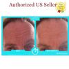 Instantly Ageless Trio-Pack FaceLift in a Box Kit