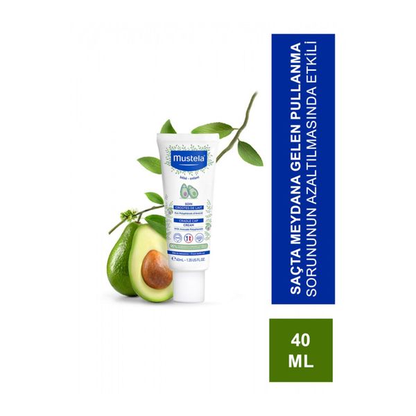 Cradle Cap Cream 40 Ml Konak Kremi