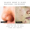 Exploring the Benefits of Pimple Soap