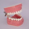 1.5 Times Large Dental Typodont Model Tooth Brushing flossing Practice Model Demonstration Removable Lower Teeth for Kids Dental Students Tooth Teach Study,  4.5 Inch x3.5 Inch x3.5 Inch