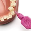 TEPE Pink G2 Fine 0.4Mm