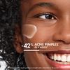 Vichy Normaderm PhytoAction Acne Control Salicylic Acid Moisturizer for Oily Skin, Moisturizing Face Acne Treatment with 2% Salicylic Acid & Hyaluronic Acid Face Lotion, Oil-Free Moisturizer