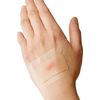 Hydrogel Burn Bandages Large Medium Waterproof Wound Dressing 8 Count Pack