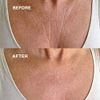 Wrinkles Schminkles Chest, Cleavage & Body Stretch Mark Wrinkle Patches | Reusable Hypoallergenic Pregnancy Safe Silicone Smoothing Pads to Prevent and Reduce Wrinkles & Stretch Marks | 1 Pack