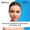 Exfoliating Face Wash with Salicylic Acid (Pack of 3) - Visible Results from Day 1 | Purifies & Unclogs Pores, Reduces Oil & Shine | Cruelty Free & Dermatologically Approved