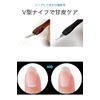 wumio Cuticle Cutter, Set of 2 Colors, Nail, Gel Nail, V-Shaped Knife, Cuticle Care, Self-Nail Tool, Pretreatment, Compact, Versatile, Cutter, Removal, Fine, Sakamuke