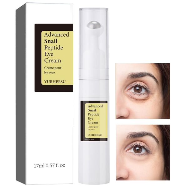 ELCHHIRSCH Snail Peptide Under Eye Cream with 73% Snail Mucin & 2% Nicotinamide for Dark Circles, Puffiness & Wrinkles, with 360° Massaging Roller Ball, 0.57 fl oz