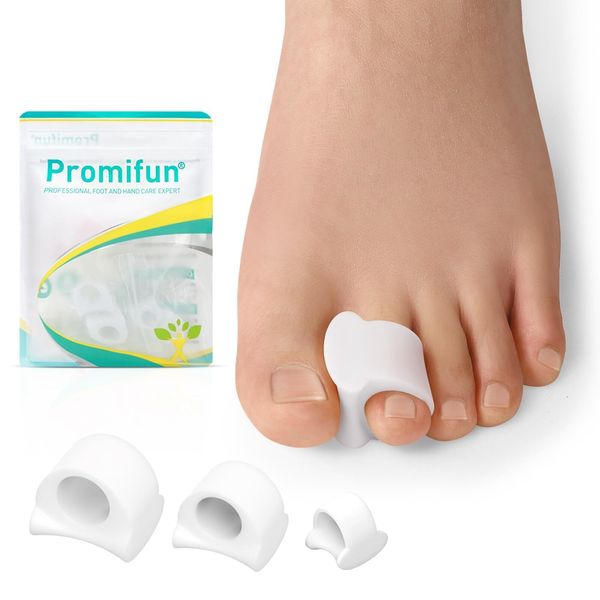 Toe Spacers Correct Toes - 12 Pack Toe Separators for Overlapping Toes Women ...