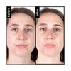 pH-In 3 Step Healthy Skin System