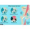 Arthritis Rheumatoid  - Hip Joint Sciatica Pain Relief & Inflammatory - made USA