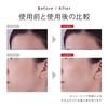 MTG ReFa SKIM SHAVER Replacement Blade (Refurbished Kim Shaver Blade)
