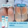 Flexitol Heel Balm 4 Oz Moisturizing & Exfoliating Foot Original Cream