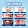 56 Pieces False Teeth, 2 Sets Whole Teeth Synthetic Polymer Denture Teeth, 23 Shade A2 Upper + Lower Dental Materials for Replacement, DIY, or Halloween