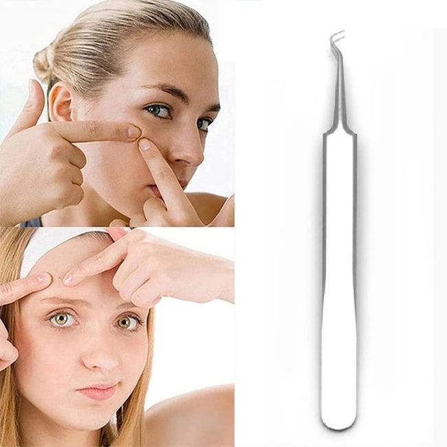 Mitesserentferner Komedonenquetscher,Blackhead Remover mit Akne Pickel Pinzette Mitesser Entferner,Pickel Ausdrücken Werkzeug für Nasen-Gesichtspflege,Mitesserentferner Comedone Extractor