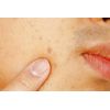 Bio Fair Anti-Blotching & Brightening Face Cream | 50ml