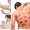 2 Cups Small Cupping For Face Neck Therapy Set Silicone Suction Vacuum Massage