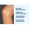 Butterfly Stitches Skin Closures – Mixed Sizes First Aid Refill Pack