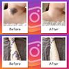 Foundation Tape (Tattoo Hidden Stickers), Made in Japan, 5 Colors, 5 Pieces, Color Matching Set, Waterproof, For Pools, Hot Springs, Tattoos, Cover Foundation Tape