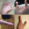 active hands Limb Difference gripping aid (Large, Left)