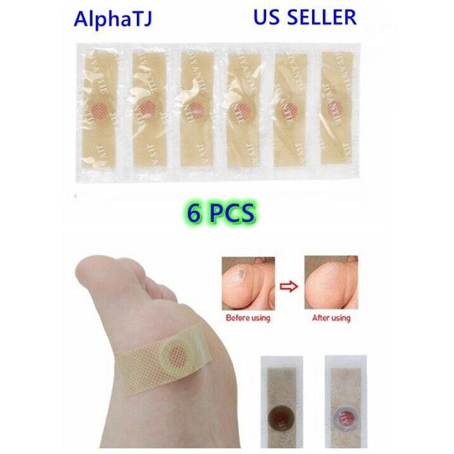 6) BEST Foot Corn Remover Pads Plantar Wart Patch Callus Toe Corn Removal