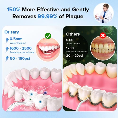 Orisary Idropulsore Dentale Portatile Senza Fili, Con 5 Ugelli E 5 Modalità, Pulisce Efficacemente i Denti, Ricarica USB, 300ML, Adatto Per La Casa E Il Viaggio Water Flosser docce orali