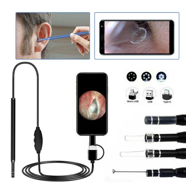 LED Ear Endoscope HD Otoscope Ear Wax Cleaning Camera Tool Cleaner Removal Kit