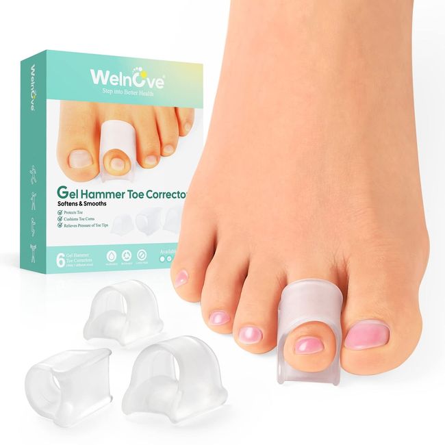 Welnove Hammertoe Corrector - Toe Straightener to Curled Toes, Broken toe, Bu...