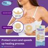 Silicone Sheets for Breast Surgery - Treatment for Reduction and Augmentation - Comfortable Under Post-Op Bra