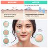 Dermasuri Deep Exfoliating Face Scrub and Body Scrub Mitt - Facial Exfoliator & Skin Cleanser - Part of the Best Skincare Kit for Women & Men - Cleanse Dead or Dry Skin - Face Exfoliation Tool