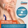 FDA-Cleared Cryo Skin Tag Remover – Quick Treatment with Applicators