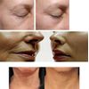 10 ML  COLLAGEN REBUILD PEPTIDE COMPLEX ( BIOPEPTIDE EL, CL )