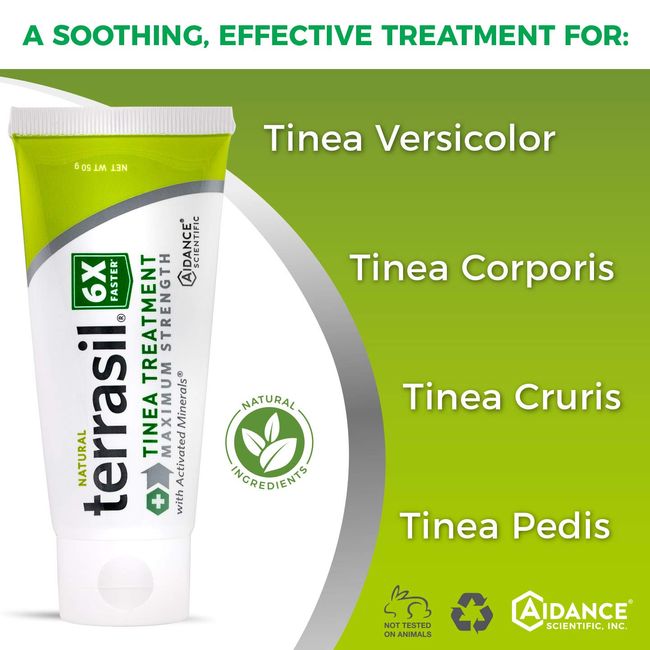Tinea Versicolor Antifungal Cream Natural Tinea Treatment Cream