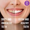 Sprinjene Fluoride Free Toothpaste for Sensitive Teeth & Gum - All Natural Toothpaste Fluoride Free Toothpaste Adult, SLS Free, Non Fluoride Toothpaste Adult - 2 Pack Toothpaste Floride-Free
