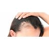 dht blocker with immune support - DHT BLOCKER HAIR COMPLEX - zinc for men 2B