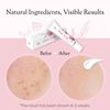 Don Du Ciel 7% Alpha Arbutin for Dark Spot Remover