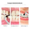 3Pcs Tooth Stain Remover, Teeth Cleaning Calculus Tool, Professional Teeth Whitening Polishing Cleaning Kit, Not Electric Cleaner Brush(White)