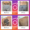 Foundation Tape (Tattoo Hidden Stickers), Made in Japan, 5 Colors, 5 Pieces, Color Matching Set, Waterproof, For Pools, Hot Springs, Tattoos, Cover Foundation Tape