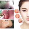 7Pcs Blackhead Acne Spot Comedone Pimple Blemish Extractor Remover Tool Kit Set