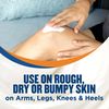 Gold Bond Rough & Bumpy Daily Skin Therapy, 8 Ounce