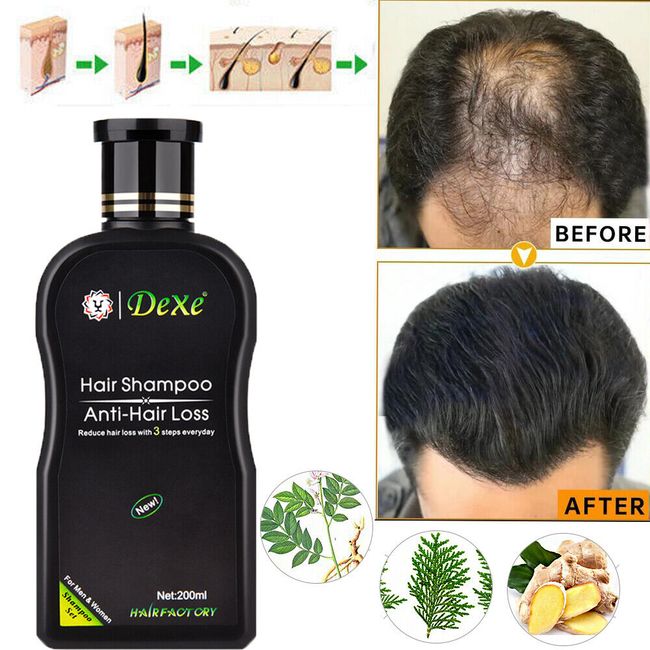 DEXE Anti-Hair Loss Shampoo Chinese Herbal Hair Regrowth For Men & Women 200ml