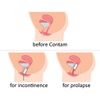 Contam Duo Vaginal Pessary 1