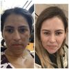 Tabella Skincare Goodbye Dark Spots Hello Brighter Skin, Fast & Effective, 5oz.