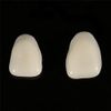 Angzhili Veneer Dental Materials Teeth Whitening Dental Supplies Ultra Thin Dental Resin Beauty Teeth Protection Top Teeth A1/A2 (A2)