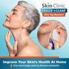 FDA-Cleared Cryo Skin Tag Remover – Quick Treatment with Applicators