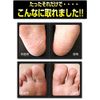 nonoji exfoliating skin training for feet