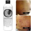 Redness Reduction with Black Soap's Natural Solution