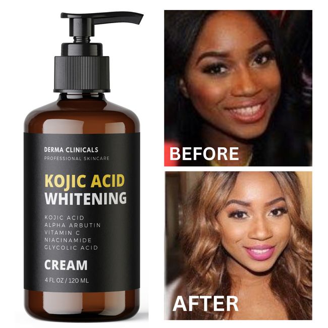 Dark Skin Whitening Dark spot  Brightening Bleaching Lightening Face body Cream