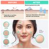 Dermasuri Deep Exfoliating Face Scrub and Body Scrub Mitt - Facial Exfoliator & Skin Cleanser - Part of the Best Skincare Kit for Women & Men - Cleanse Dead or Dry Skin - Face Exfoliation Tool