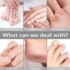 Professional Manicure & Pedicure Kit: Rechargeable Nail Grinder for Thick Nails